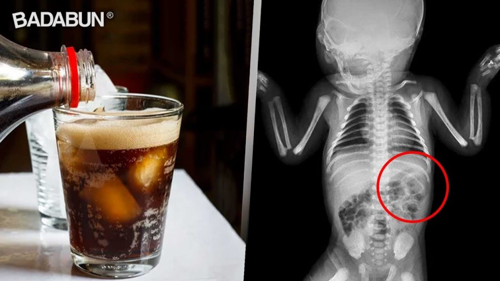 Médicos suplican a Padres no Dar Coca Cola a sus Hijos – Monse Club